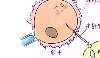 45岁高龄女性做试管婴儿应该选择怎样的医院