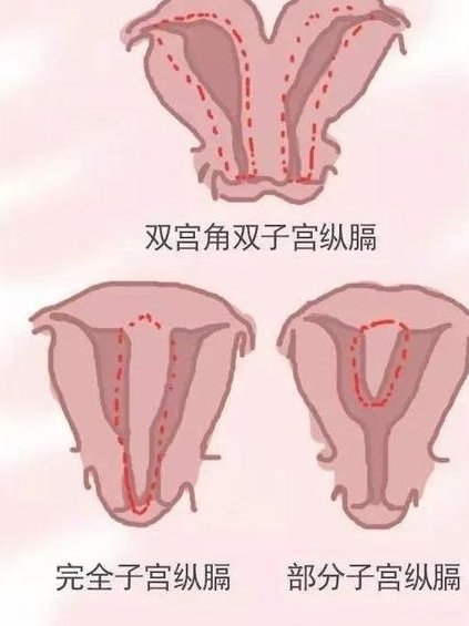 内膜13b适不适合试管移植？