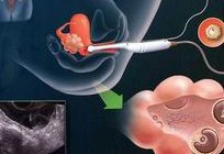 天津城关大概需要多少钱做第三代试管婴儿，医院有哪些？