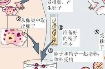 人工授精女方需要做哪些检查项目，人工授精基本条件是？