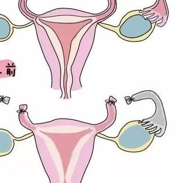 FSH与LH比值跟卵泡质量有关系吗？如何判断卵泡质量好坏？